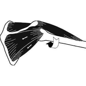 ShoulderHorn Rotator Cuff Training Device - Image 5